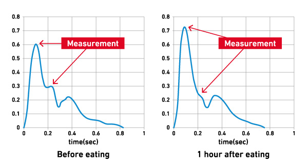 Changes in Pulse-Wave Patterns Before and After Eating