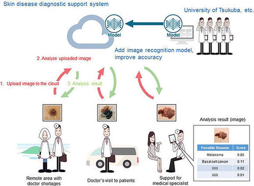 KYOCERA Begins Research in AI-based Image Recognition to Help Diagnose Skin Diseases and Cancers via Smartphone
