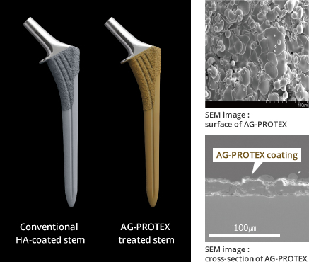 Figure : Conventional HA-coated stem,AG-PROTEX treated stem,SEM image: surface of AG-PROTEX,AG-PROTEX coating, SEM image:cross-section of AG-PROTEX